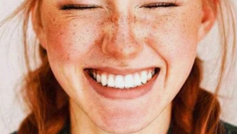 Benefits of Dental Crowns for Your Teeth