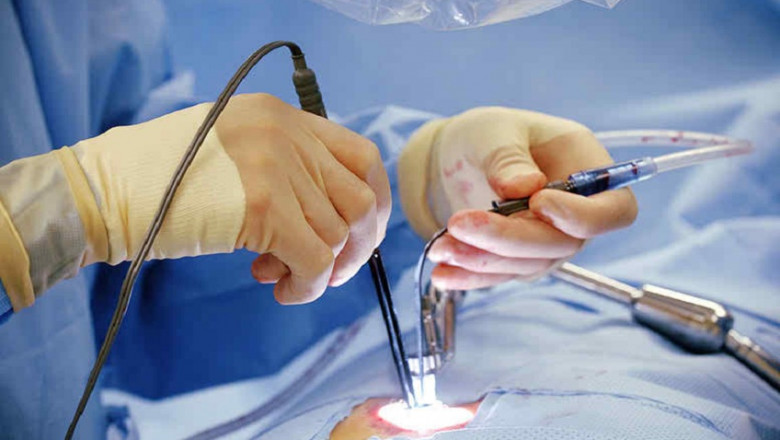What is Minimally Invasive Spine Surgery?