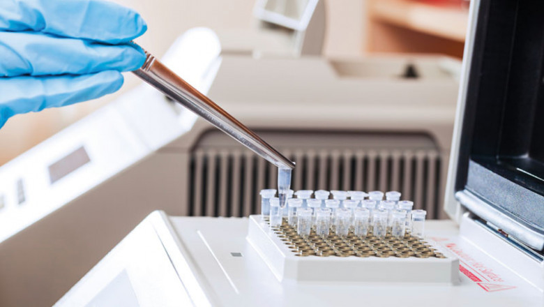 Specimen Validity Testing Market to Witness High Growth, Dynamics, Production, Demand Analysis and Forecast 2022-2029