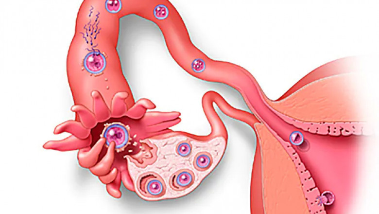What is Implantation?