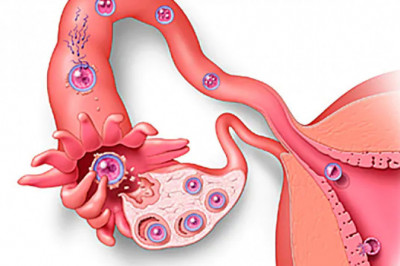 What is Implantation?