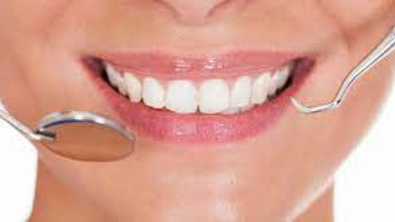 What Is Invisalign And How Does It Work?