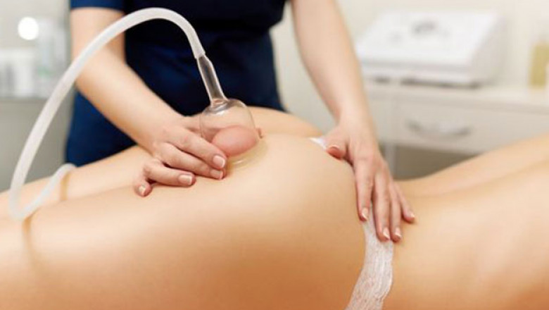 9 Benefits of Ultrasonic Cavitation Treatment