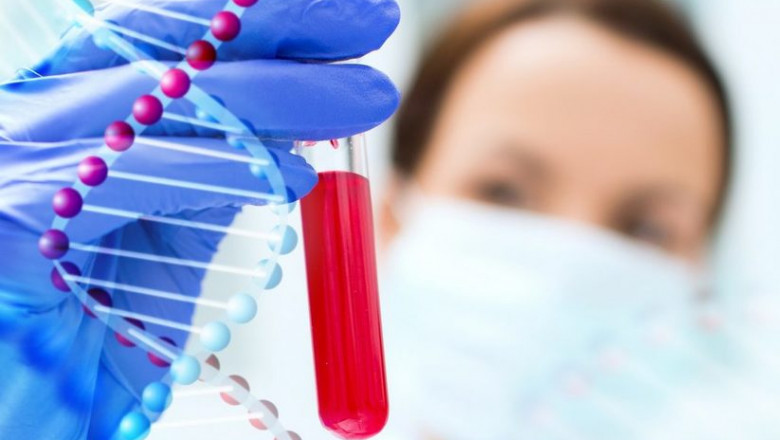 Anti-Obesity Therapeutics Industry Research 2021 Global Report With Impact Analysis | Research Informatic