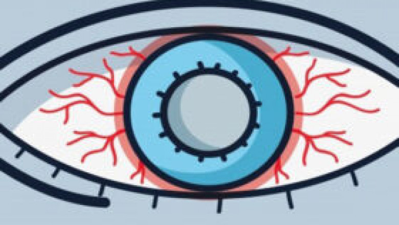 How long does it take to notice weight loss |webhealth