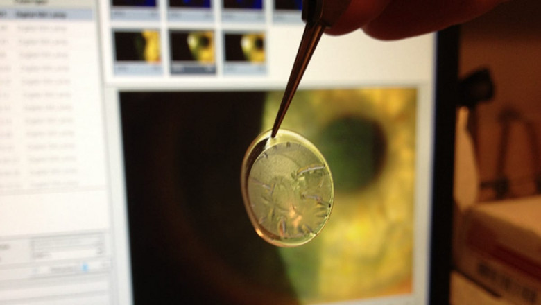 Amniotic Membrane Market Size, Share & Trends Report Amniotic Membrane Market Size, Share & Trends Analysis Report By End Use (ASC, Hospital), By Enzyme (Dehydrated, Cryopreserved)