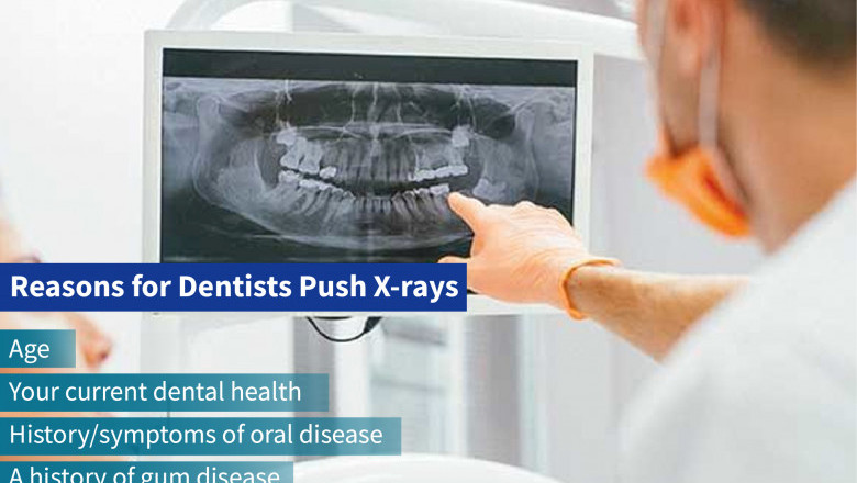 Reasons for Dentists Push X-rays | Emergency Dental Care