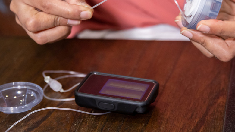 The High Cost Of Insulin Pumps, Is Limiting The Adoption Of Insulin Pumps, Which May Impede The Growth Of The Global Insulin Pump Market