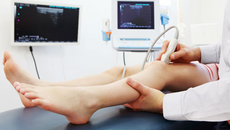 Doppler Ultrasound Market - GROWTH, TRENDS, COVID-19 IMPACT, AND FORECASTS (2022 – 2027)