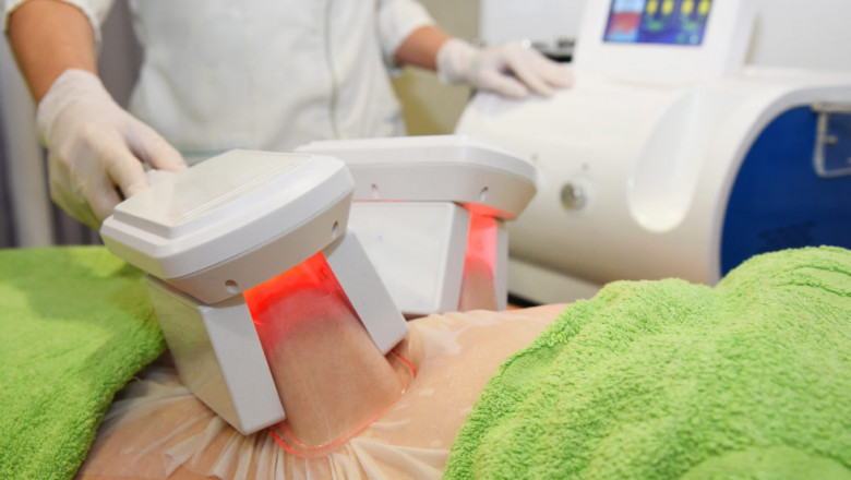 Fat Freezing Treatment For Body Contouring