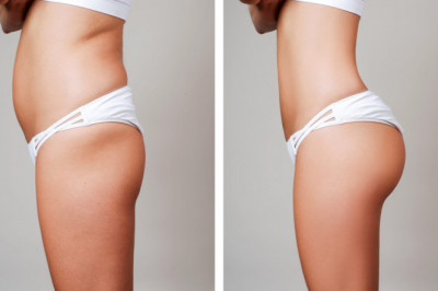 Plastic surgeries that makes you more attractive