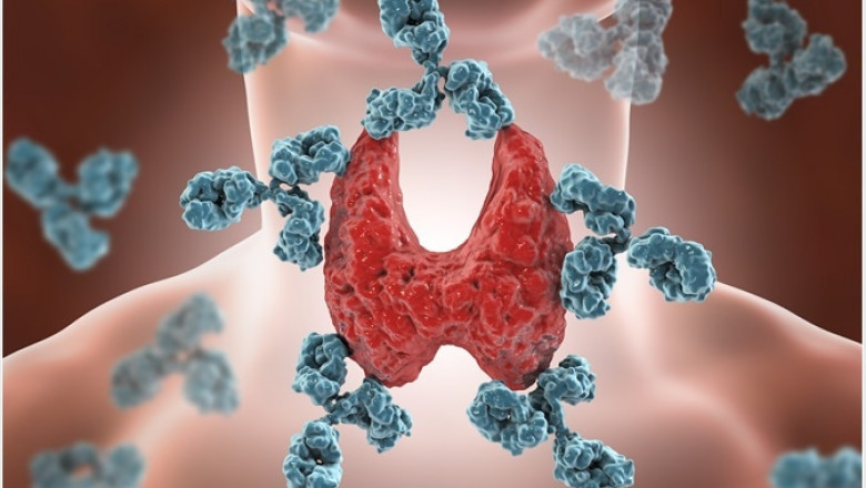 Autoimmune Disease Treatment Market is Expected to Reach USD 7.95 Billion by 2025