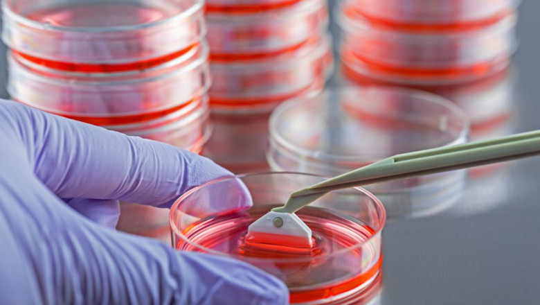 Global Tissue Transplantation Market Drivers