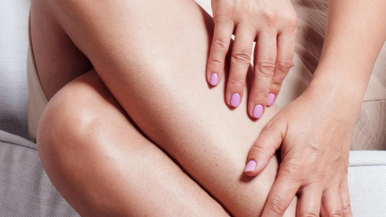 What Types of Doctors Treat Varicose Veins?