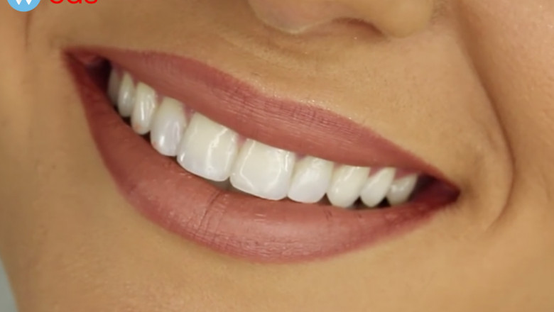 24 Hour Dentist in Warsaw, IN 46580 - Schedule An Appointment Today