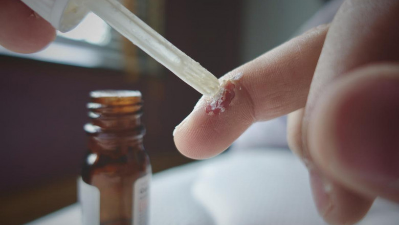 SALICYLIC ACID MARKET - GROWTH, TRENDS, COVID-19 IMPACT, AND FORECASTS (2022 – 2027)