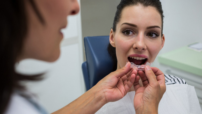 more About Invisalign and Its Effectiveness?