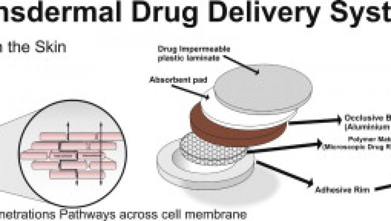 Transdermal Drug Delivery Systems Market - Global Industry Analysis, Size, Share, Growth, Trends, and Forecast, 2020 – 2030