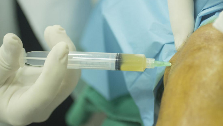 PLATELET-RICH PLASMA MARKET - GROWTH, TRENDS, COVID-19 IMPACT, AND FORECASTS (2022 – 2027)