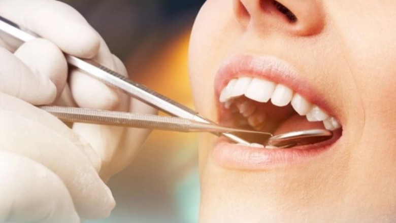 7 Signs To Go For Wisdom Teeth Removal