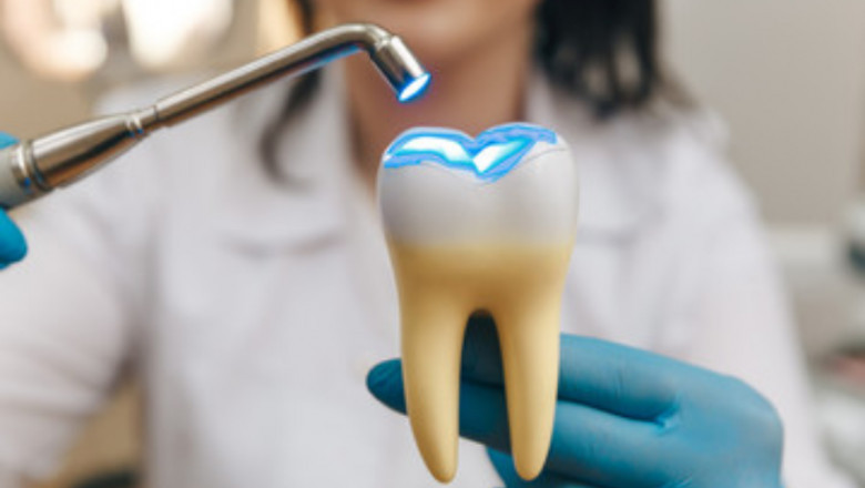 How Are White Composite Fillings Helpful In Dealing With Teeth Issues?