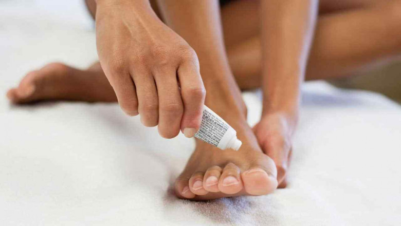 Know about the symptoms of nail fungus