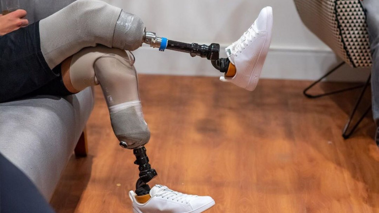 Evaluation of Prosthetic Leg