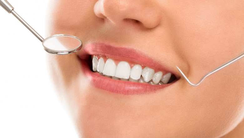 Is there any difference between over-the-counter tooth whiteners and zoom?