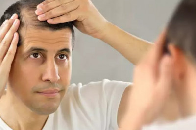 Is Hair Transplant A Long Lasting Procedure?