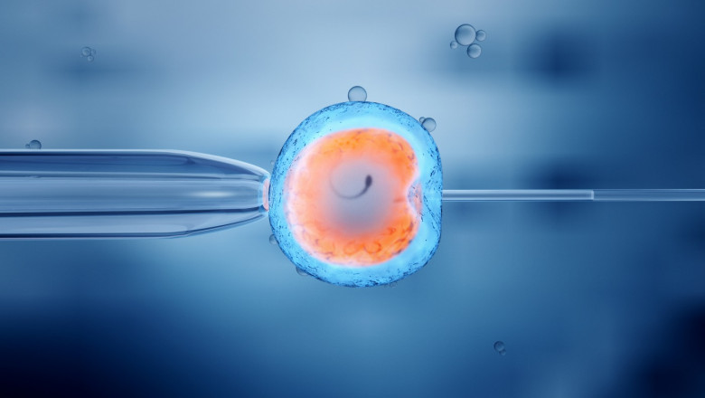 What Is In Vitro Fertilization (IVF)?