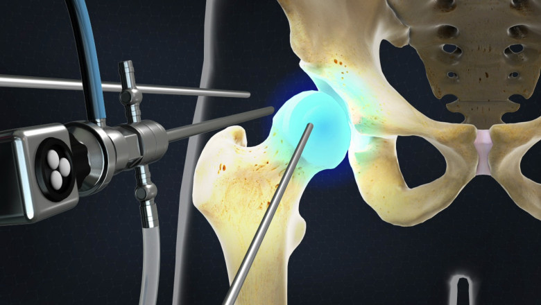 Global Arthroscopic Devices Market: Region-wise Outlook