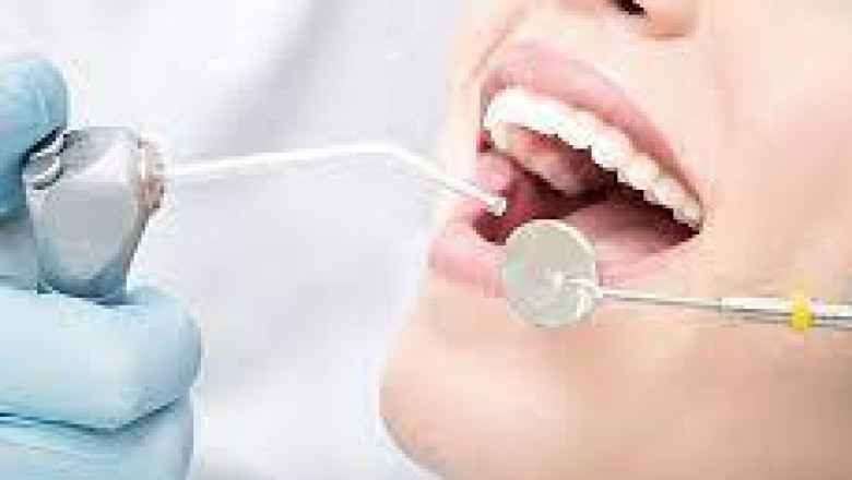What To Expect During A Dental Implant Consultation?