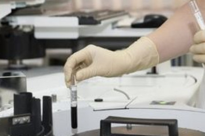 In-Vitro Diagnostics Market Pharmaceuticals and Healthcare Analysis 2027