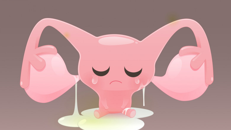 What is The White Discharge From Females Before Period?