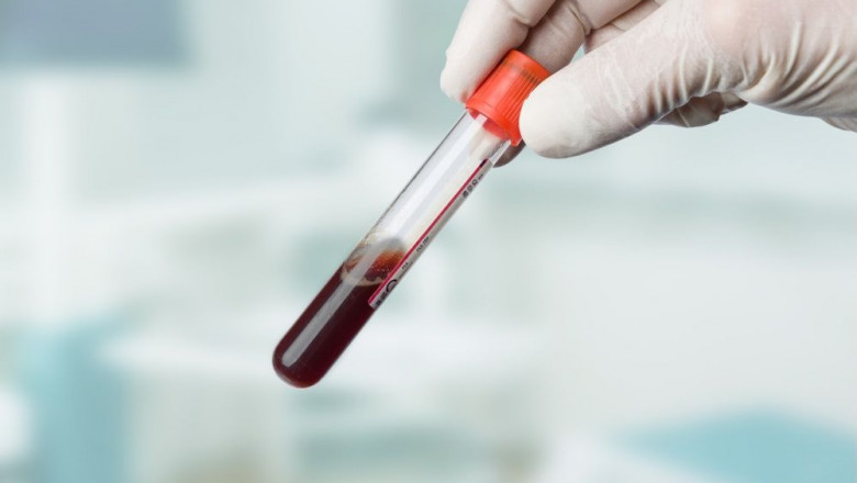 Artificial Blood Market Overview