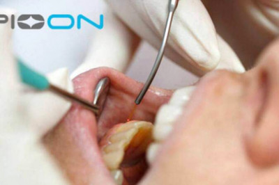 Are Laser Dental Procedures Better Than Traditional Treatments?