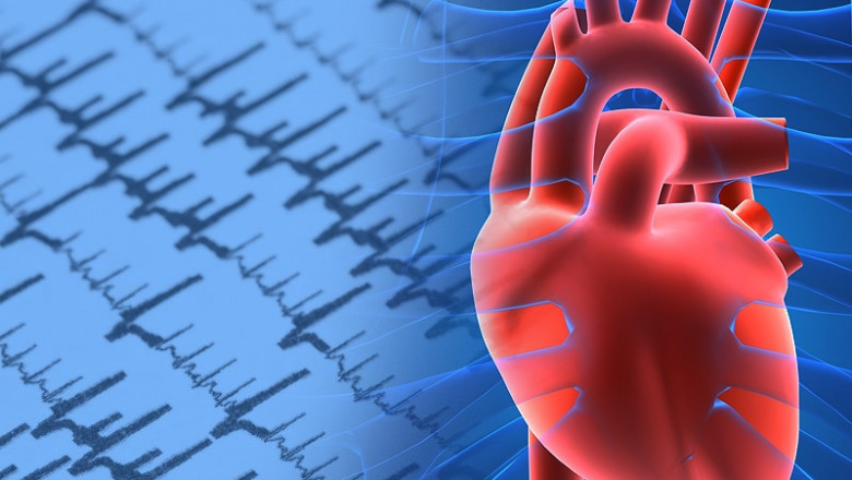 Atrial Fibrillation Market Drivers