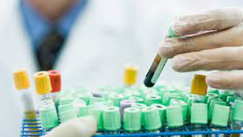 Autoimmune Disease Diagnostics Market - Global Industry Analysis by Size, Share and Forecast 2022 – 2027