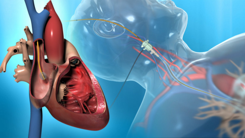 Impact of Covid-19 on Pulmonary Arterial Hypertension Market