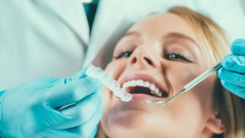 All You Need To Know About Smile Makeover