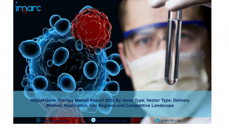 Gene Therapy Market Overview, Size, Share, Trends, Key Vendors, Regions Demand, Growth and Forecast to 2027
