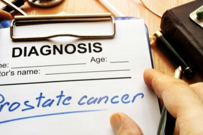 Colorectal Cancer Screening Exams