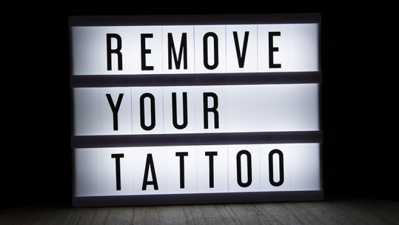 Tattoo Removal Market - Global Industry Growth and Forecast – 2027