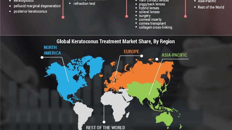 Keratoconus Treatment Market Trends, insights, latest trends, future growth, share value and sales projection 2027