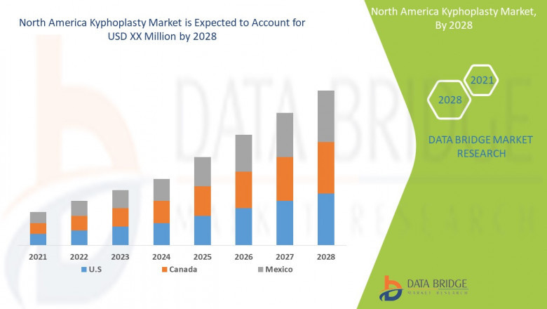 Kyphoplasty Market – North America Industry Trends & Forecast to 2028