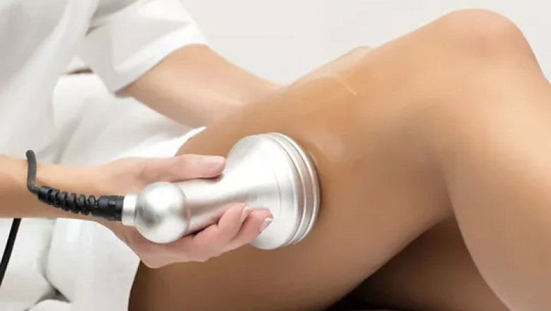 Does cupping vacuum therapy last forever?