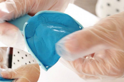 Fast teeth whitening