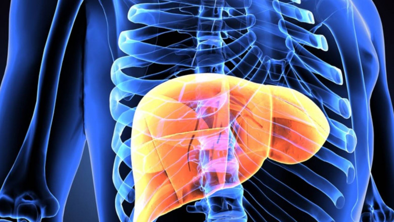 Hepatocellular Carcinoma Drugs are prescribed for cancer patients to minimize side-effects of chemotherapy and kill cancer cells