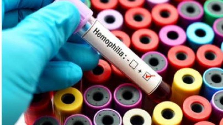 Prevent obesity and related health conditions With complete health checkup