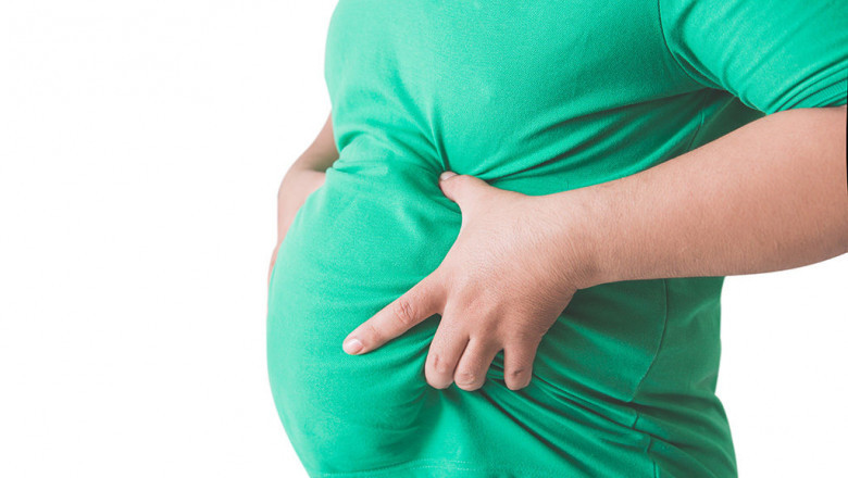 5 Facts About Obesity That You Should Know About